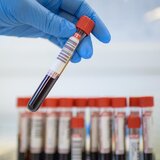 Home Medica - Serviciu asistenta medicala la domiciliu